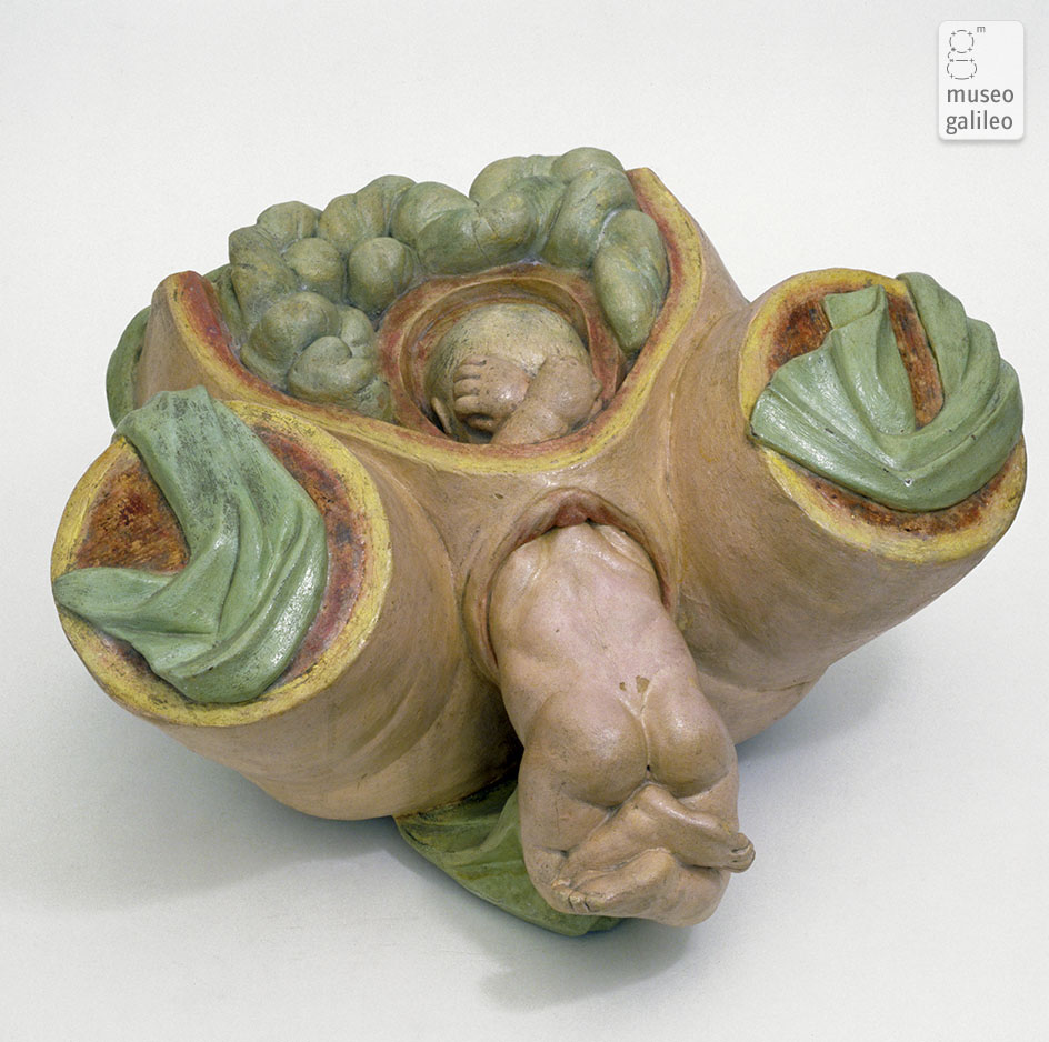 Model of breech birth (Dep. OSMN, Firenze)